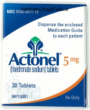 purchase actonel 35mg with amex